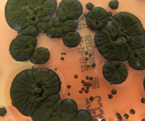 gribok plesen chernobil